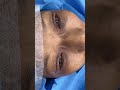 Upper eyelid blepharoplasty