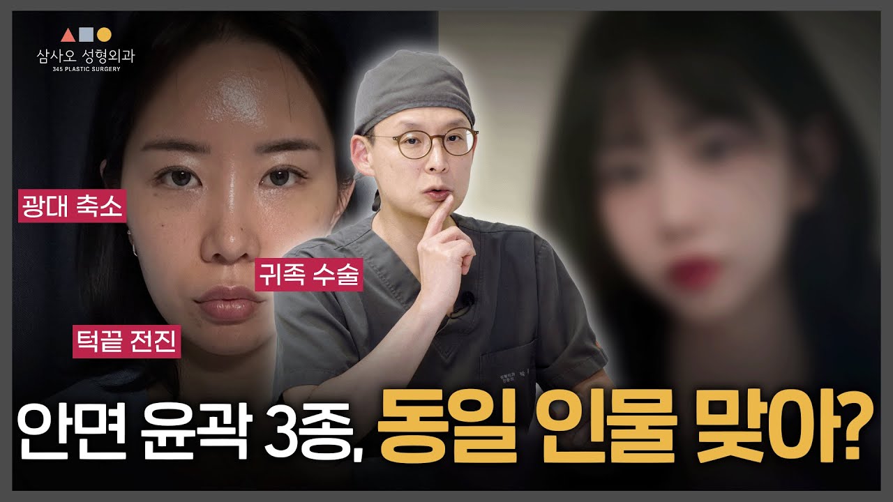 광대 축소술+귀족 수술+턱끝 전진 보기 전엔 절대 믿기 힘든 변화