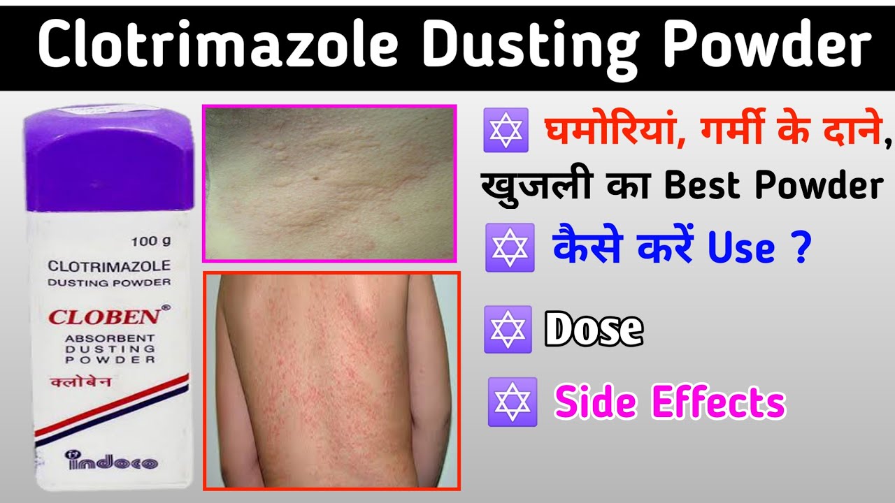 Cloben Dusting Powder / Clotrimazole 1 powder / Cloben powder uses
