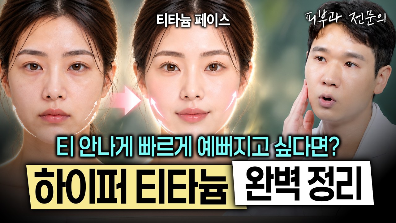 효과는 좋은데 유지가 아쉬웠던 티타늄 리프팅, 드디어 보완됐습니다｜하이퍼 티타늄, 1세대와 뭐가 다른지 피부과 전문의가 완벽 정리