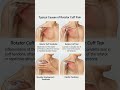कंधे के दर्द का सही कारण और इलाज Shoulder Rotator cuff injury #RotatorCuffPain ShoulderPainRelief