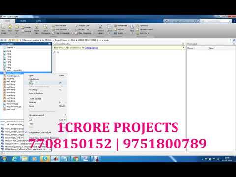 Brain MRI Images Using Segmentation Based Object Labeling Algorithm - 1Crore Projects