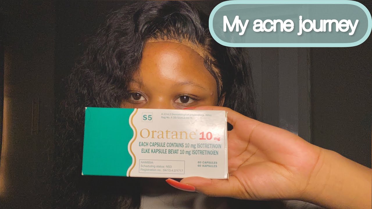 Is Oratane Accutane The Cure To Acne My Acne Journey YouTube