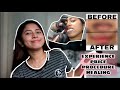 AFFORDABLE Liptint Embroidery / LipTattoo | Day to Day Healing Process (Semi-Permanent Makeup)