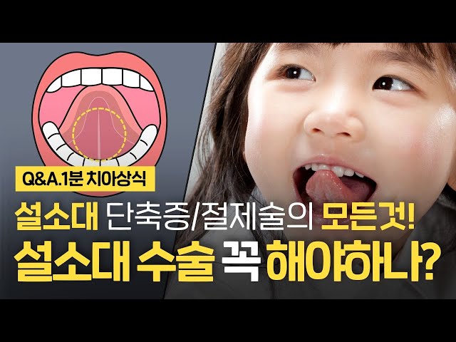 설소대 수술은 꼭 해야만 할까? 설소대단축증 발음 설소대절제술에 대한 모든것!
