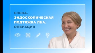 Елена. Эндоскопическая подтяжка лба. Операция