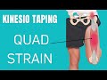 How to treat a strain of the Rectus Femoris (Quadricep) muscle using Kinesiology Tape