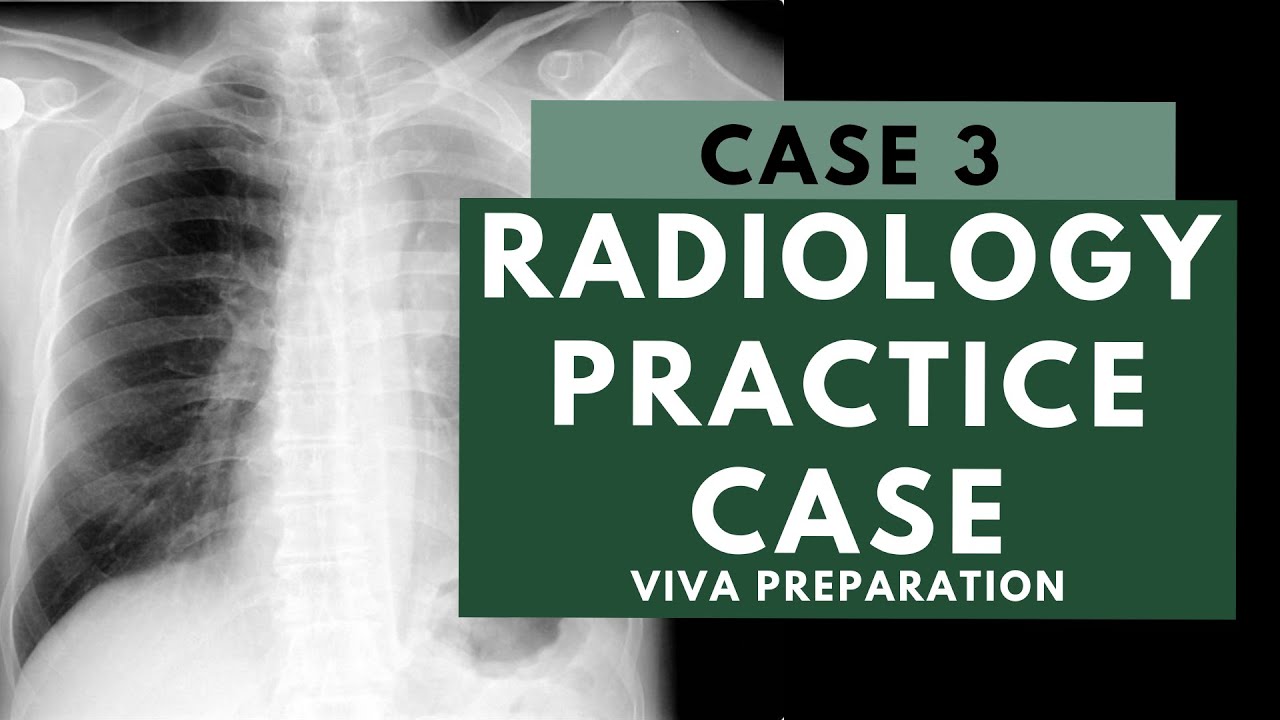Radiology Viva Practice Case: 3 - FRCR 2B preparation