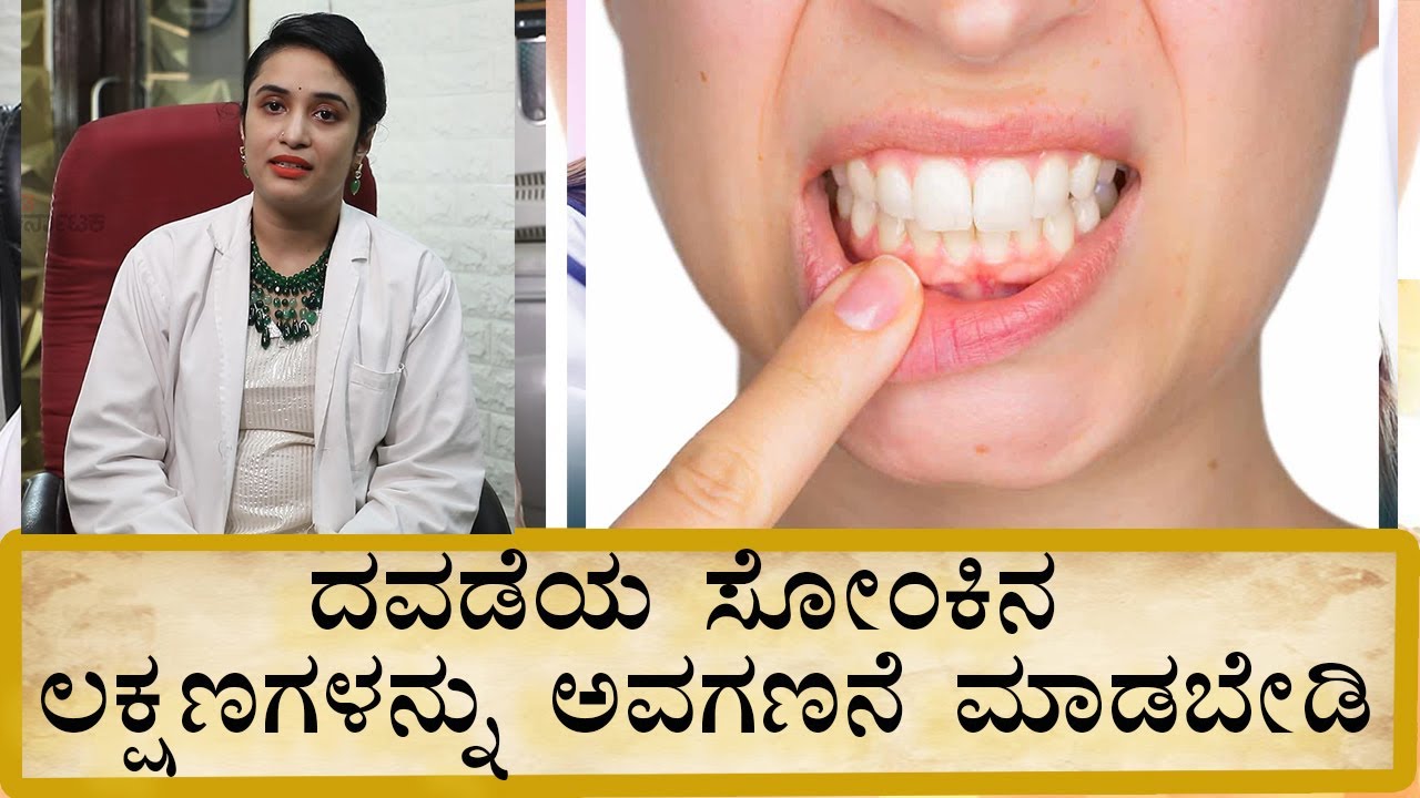 Periodontitis - Diagnosis and treatment | ದವಡೆಯ ಸೋಂಕು: ಲಕ್ಷಣಗಳು ಮತ್ತು ಚಿಕಿತ್ಸೆ | Vijay Karnataka