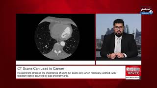 Study warns CT scan overuse could lead to 100,000 future cancer cases in US