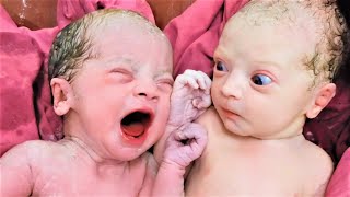Why this baby is so much Surprised while other is Crying. Looks amazing in dress. #twins frm Triplet