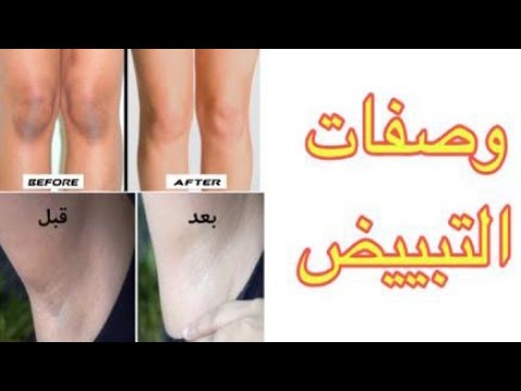 Liked on YouTube: وصفات تبييض المناطق الحساسة و جميع المناطق...