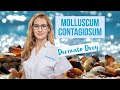 Molluscum Contagiosum : encore un virus ! Mi-bouton mi-verrue ! #DermatoDrey
