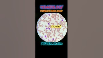 Peripheral Blood Smear | PBS Examination | Blood Smear Preparation | Hematology |#bloodtest #lab