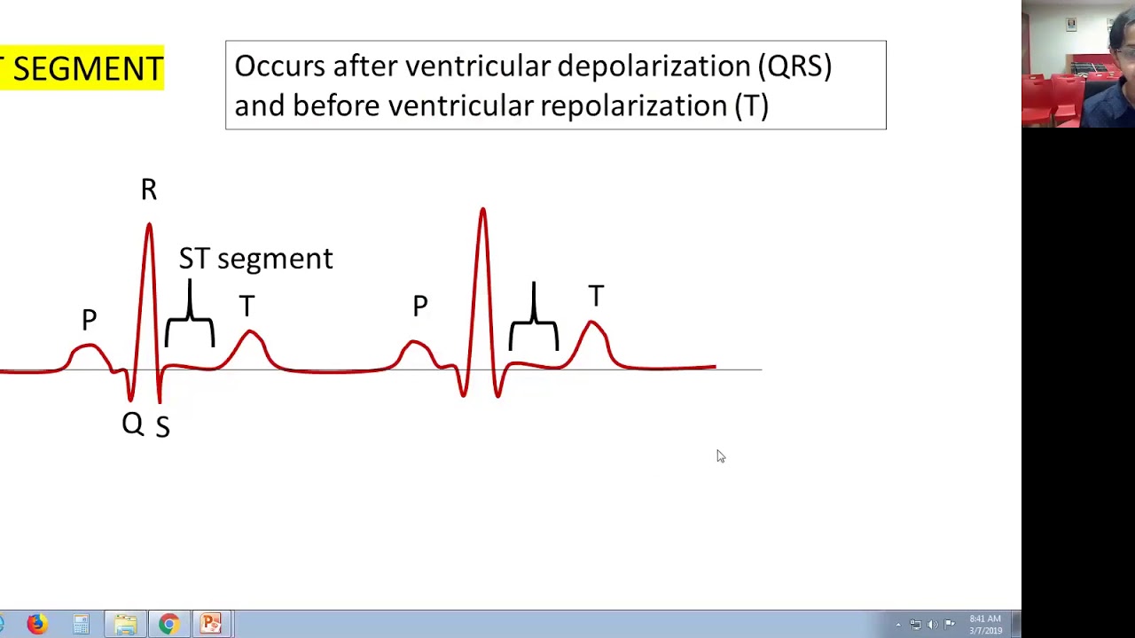 Normal ECG continuation 20190307 0301 1