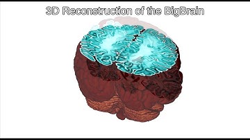 Big Brain Video Oct 2016