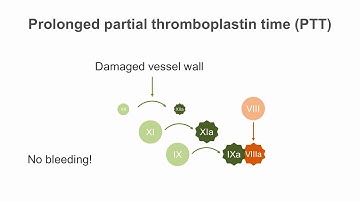 Interpreting the Partial Thromboplastin Time (PTT)