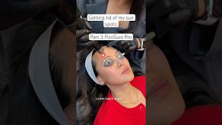 Getting rid of my sun spots: Part 3 PicoSure Pro