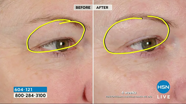 NassifMD Peri Orbital Eye Complex Duo