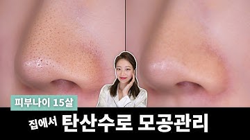 피부나이 15살? 집에서 천원으로 모공 관리하는법! (모공줄이기, 모공청소 블랙헤드관리) #김희선세안 #여배우피부되는법