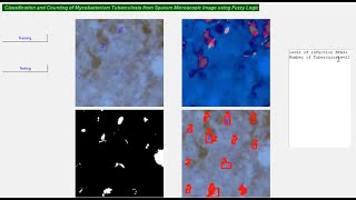 Classification and Counting of Mycobacterium || Engineering Project || Final Year Project || Python