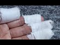 تحرڨت يدي الحمد الله هكذا ولا كثر أرواحو نڨصرو توحشتكم