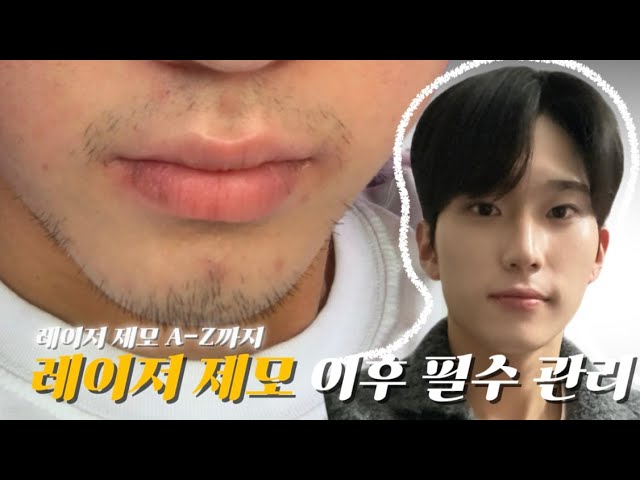 [댓글 Event까지!!]🧔거뭇거뭇한 수염 자국 싹-없애는 레이저 제모 이후 필수 관리✨..(feat.자극없이 순하게 관리하는 법)