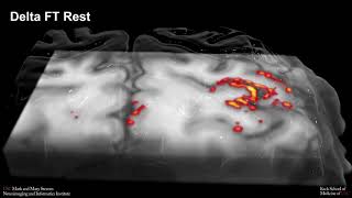 Comparison between finger tapping (FT) and finger brushing (FB) evoked perfusion activation, 7T fMRI