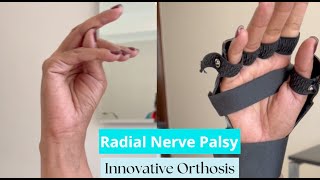 Radial Nerve Palsy