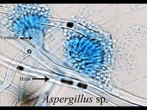 Técnicas básicas de microbiología: Tinción de hongos con Azul de Lactofenol  - YouTube