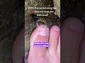 Best Pedicure Hands Down Shorts 