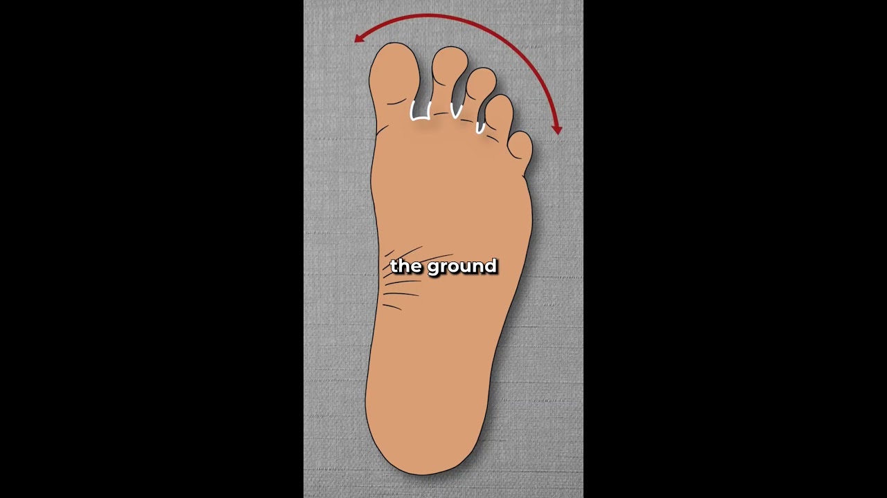 How Bunions Actually Begin Shorts