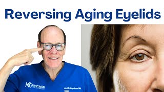 How to Prevent Aging Eyelids | Oculoplastic Surgeon Insights