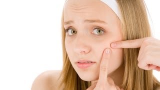 What Are Home Remedies That Work? | Acne Treatment