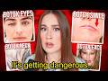 BOTOX SIDE EFFECTS ARE DESTROYING YOUR FACE (irreversible damage)