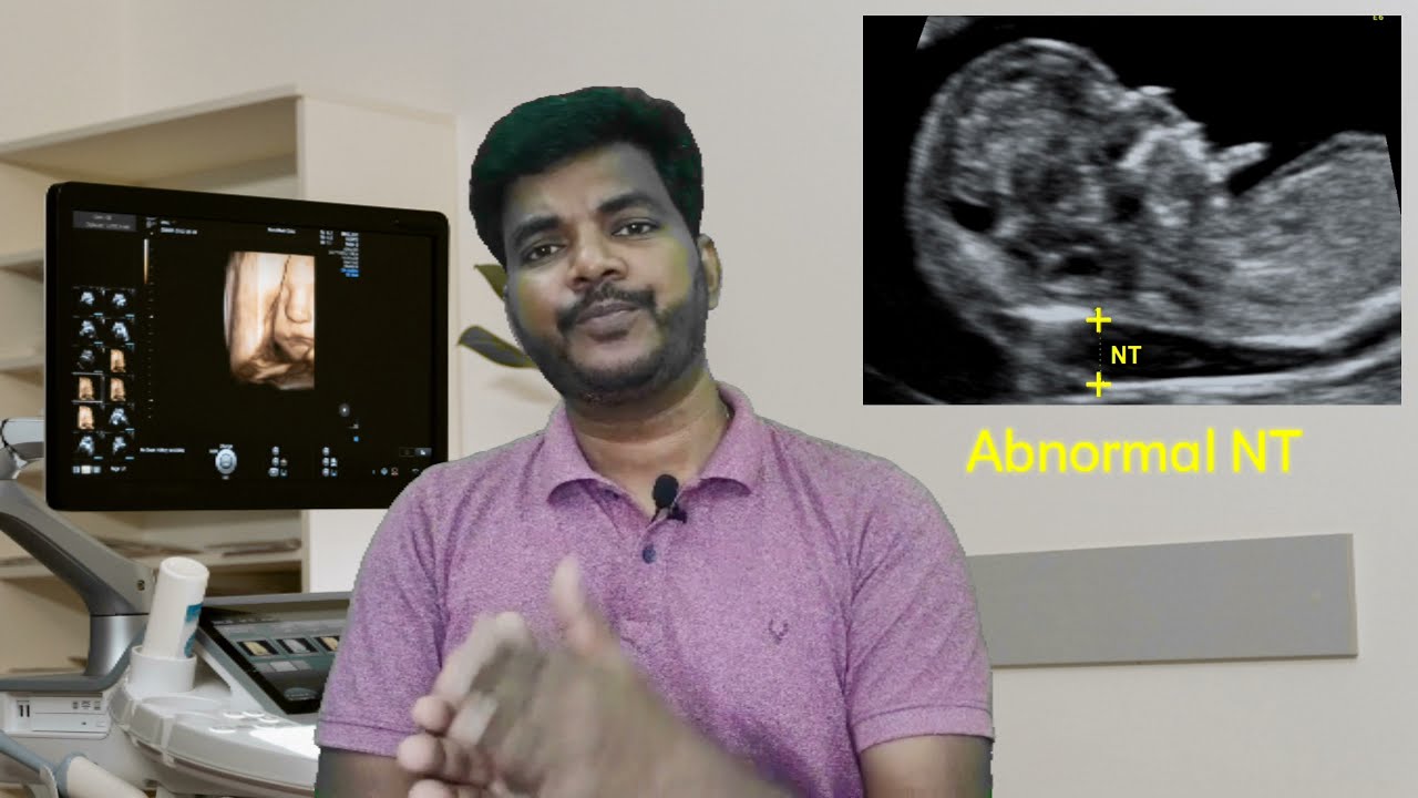 What Is NT Scan In Tamil NT Scan Tamil YouTube