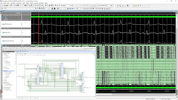 Extraction of Fetal ECG from Abdominal and Thorax ECG Using a Non-Causal Adaptive Filter