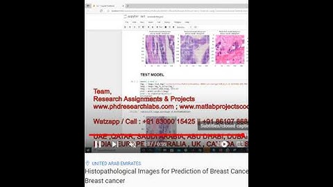 Histopathological Images for Prediction of Breast Cancer Using python code - Breast cancer