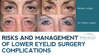 Lower Eyelid Surgery Complications: Risks, Revisions, and How to Minimize Them
