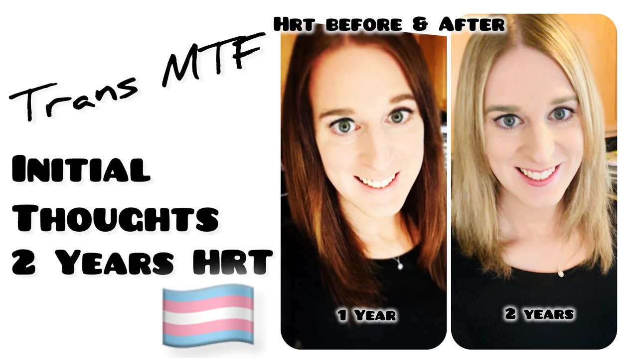 Trans MTF two years HRT | Before and After