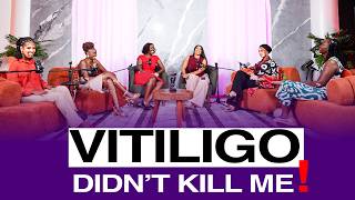 Vitiligo Didn’t Kill Me, It Made Me | A Conversation with Mami Deb The Truth About Vagina Bleaching Premier Podcast Episode 1