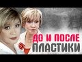 Маша Малиновская, Роза Сябитова и другие Российские звезды до и после пластики