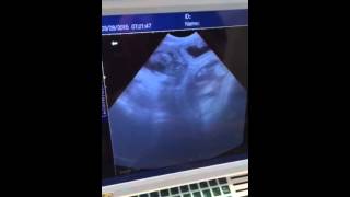 Nalas Ultrasound Puppies Moving