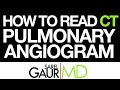 How to Read a CT Pulmonary Angiogram (CTPA or PE Study)
