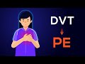 Overview of Acute Pulmonary Embolism in adults: (From DVT to PE)