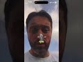 ОТЗЫВ ПЕРЕСАДКА ВОЛОС ДО ПОСЛЕ 164