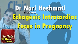 EICF: Echogenic Intracardiac Focus on Ultrasound in Pregnancy Discussed by Dr Nari Heshmati screenshot 4