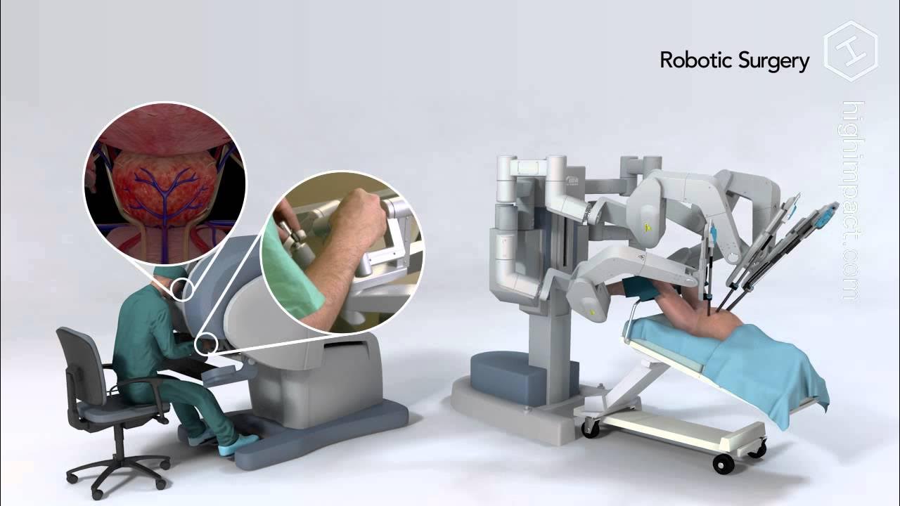 Простатэктомия роботом. Робот ассистированная простатэктомия. Простатэктомия роботом «да Винчи». Роботизированная радикальная простатэктомия. Робот ассистированная хирургия.