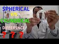 Spherical Vs Cylindrical lenses| Difference in Cylindrical power and Spherical power| Astigmatism