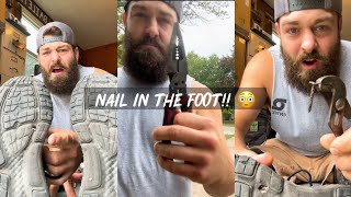 Man Finds Nail Stuck In His Foot